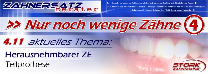 Nur noch wenige Z&auml;hne